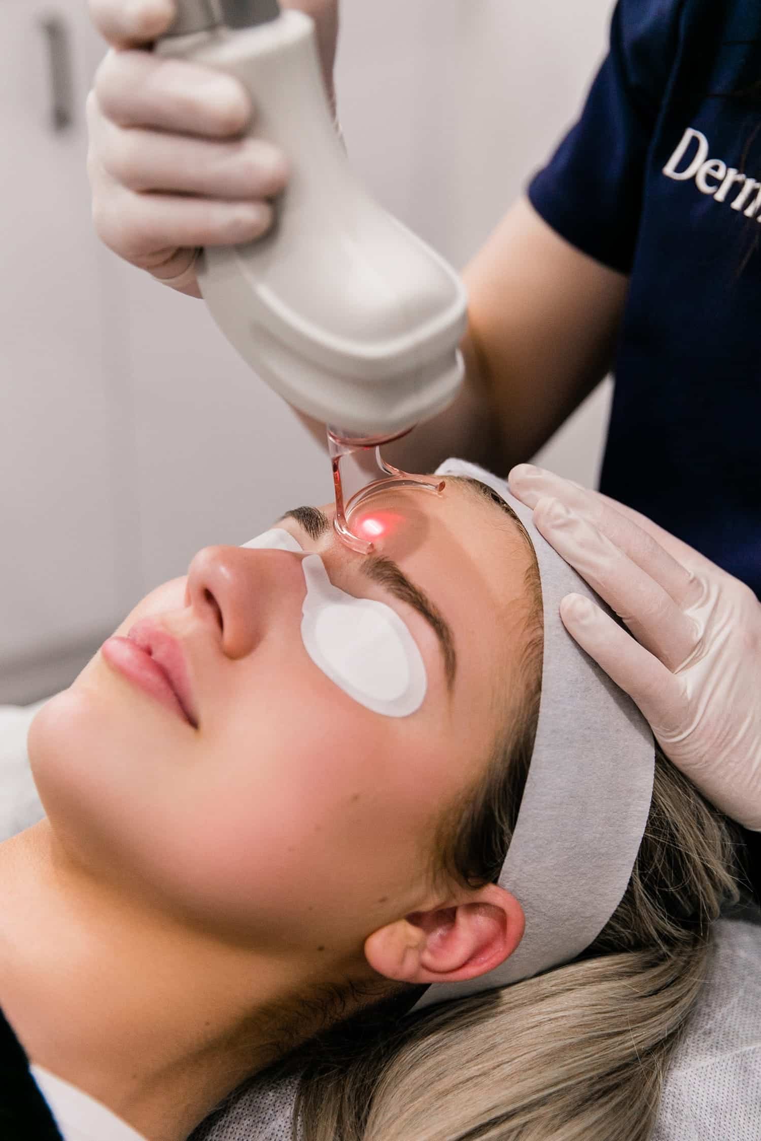 Fractional Laser face / ATHENS RIVIERA CLINIC