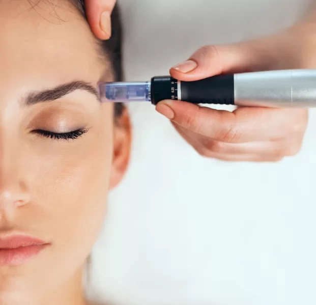Dermapen – Μικροβελονισμός για Ανάπλαση & Αναζωογόνηση στην Athens Riviera Clinic Το Dermapen είναι μια προηγμένη τεχνική μικροβελονισμού (microneedling) που ενεργοποιεί τη φυσική παραγωγή κολλαγόνου και ελαστίνης, προσφέροντας λείανση, σύσφιξη και αναζωογόνηση του δέρματος. Στην Athens Riviera Clinic, χρησιμοποιούμε τελευταίας τεχνολογίας συσκευές Dermapen για τη βελτίωση της υφής του δέρματος, την αντιμετώπιση ουλών και την ανανέωση της επιδερμίδας.